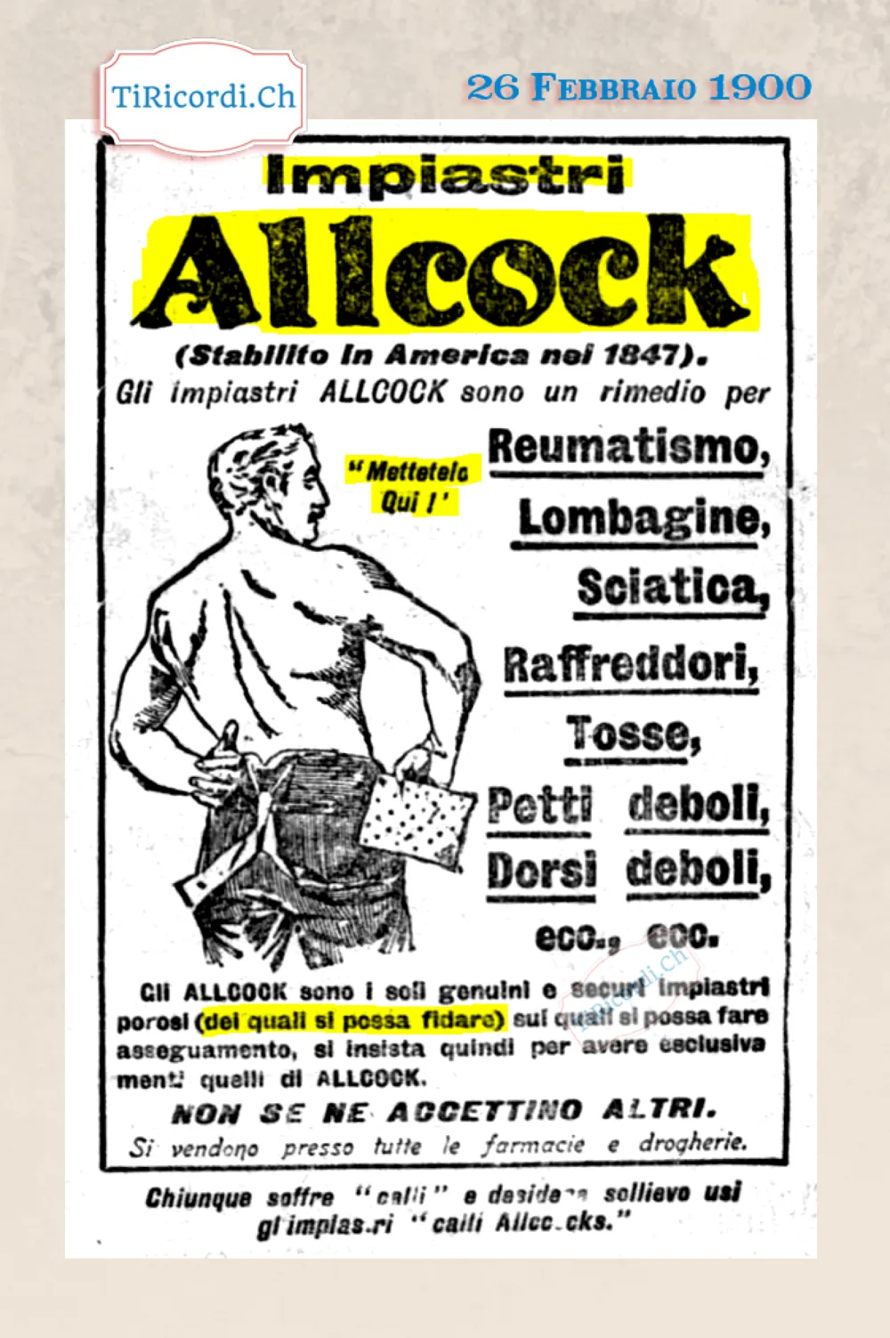 Impiastri Allcock: metteteli qui, per reumatismo, sciatica, tosse e dorsi deboli, 1900